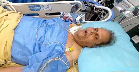 सत्यपाल मलिक: 2200 करोड़ के भ्रष्टाचार केस में CBI ने दाखिल की चार्जशीट, अस्पताल में भर्ती हुए पूर्व राज्यपाल