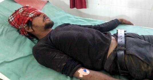 शामली में बड़ा हादसा, सड़क हादसों में तीन घायल, एक हायर सेंटर रेफर